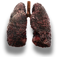 lungs