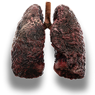 lungs