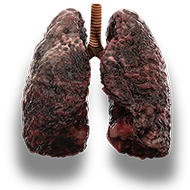 lungs