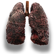 lungs