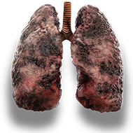 lungs