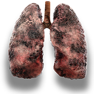 lungs