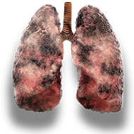 lungs