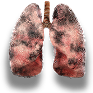 lungs