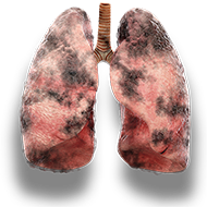 lungs