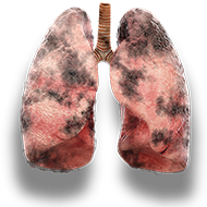 lungs