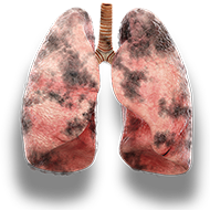 lungs