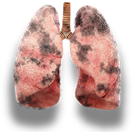 lungs