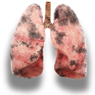 lungs