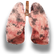 lungs