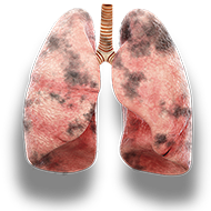 lungs