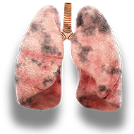 lungs