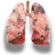 lungs