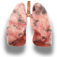 lungs