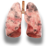 lungs