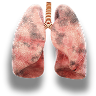 lungs