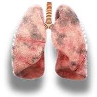 lungs